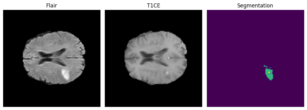 One preprocessed training sample: FLAIR channel, T1ce channel and segmentation at 128 by 128.