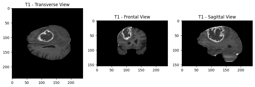 The same T1ce volume viewed in transverse, frontal and sagittal planes.