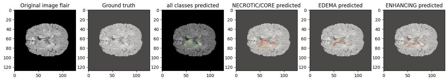 The same six-panel prediction layout for a second held-out test patient.