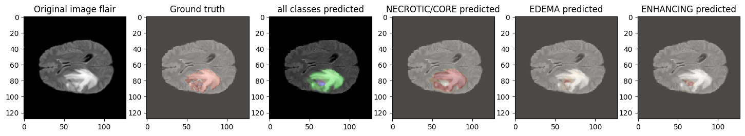 Six-panel U-Net prediction breakdown for a third test patient.