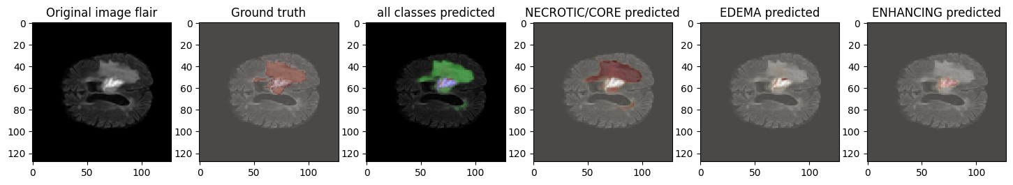 Six-panel U-Net prediction breakdown for a fourth test patient.